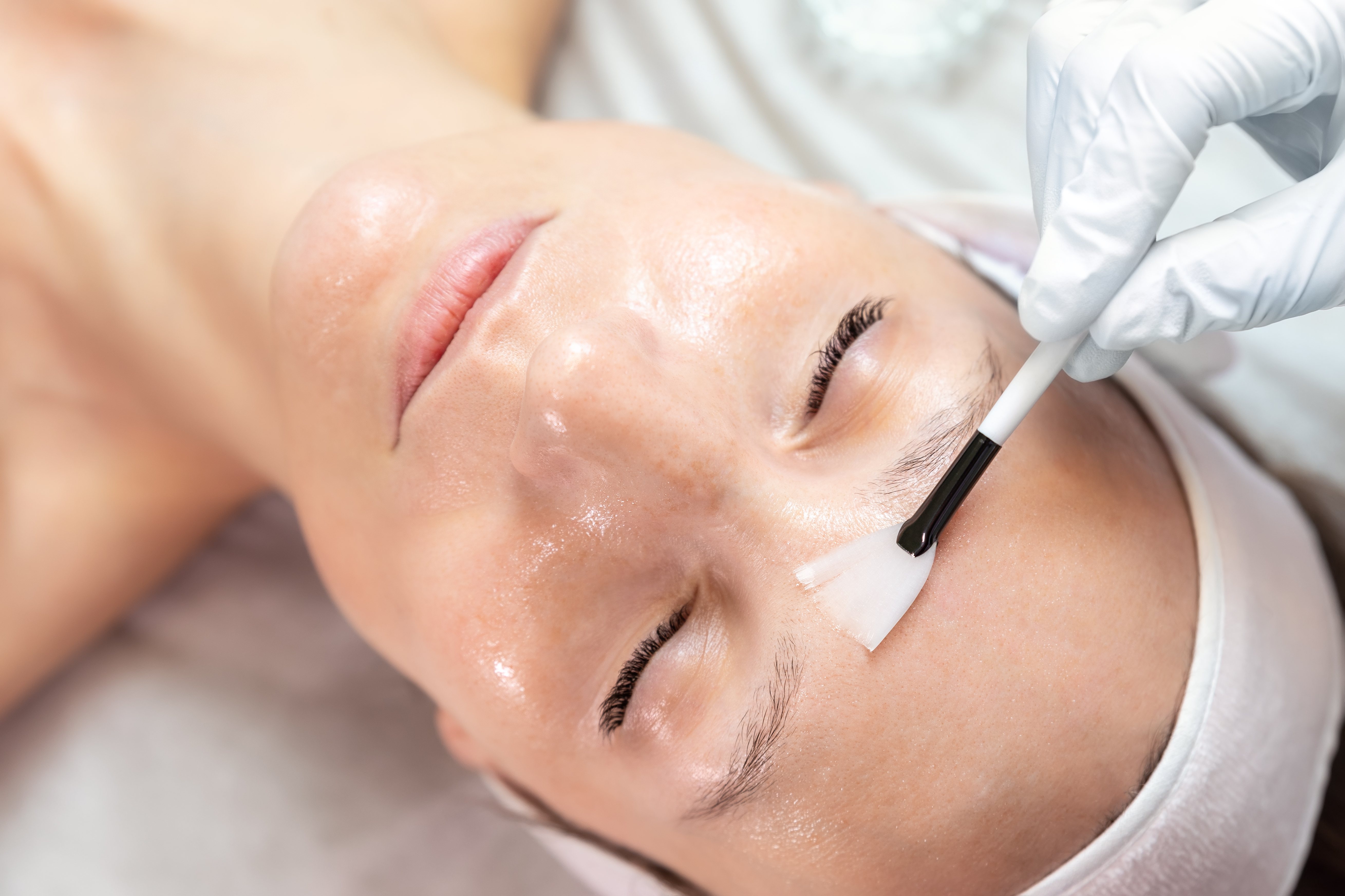 Chemical Peels At The Beauty Cellar NY