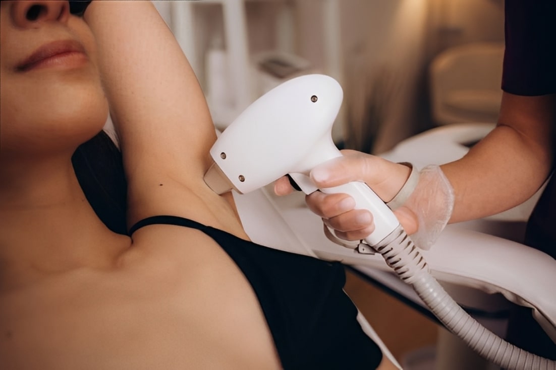 Laser Hair Removal In New Hyde Park Long Island NY
